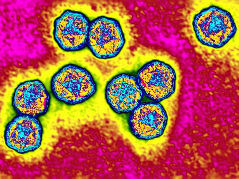 Hepatitis A virus (HAV). Image produced using high-dynamic-range imaging (HDRI) from an image taken with transmission electron microscopy. Viral diameter ranges from around 20 to 30 nm.